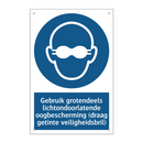 Gebruik grotendeels lichtondoorlatende oogbescherming (draag getinte veiligheidsbril)