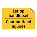 Let op handletsel - Caution Hand Injuries