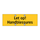 Let op! Handblessures