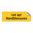 Let op! Handblessures